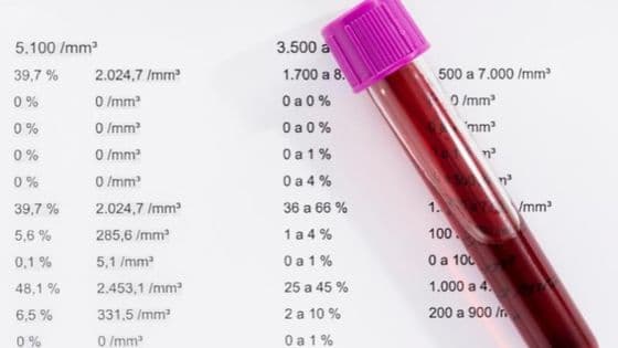 Mutirão de exames laboratoriais acontece neste sábado com cerca de 200 atendimentos - Portal da Cidade - Brusque / SC
